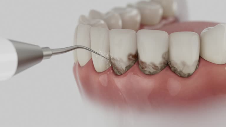 Reliable Dental Implants contractor in Monticello, WI by Smile Center Dentistry
